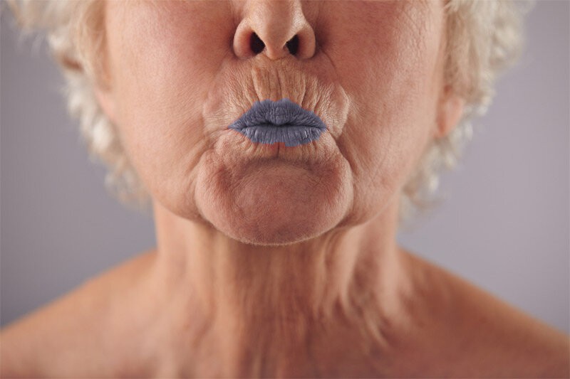 9 распространенных причин почему синеют губы у взрослого человека и ребенка