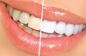 7 bezopasnyh sposobov estestvenno otbelit zuby 5